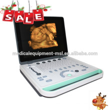 Machine à ultrasons portable 3d / machine usg portable / ordinateur portable à ultrasons MSLPU34A